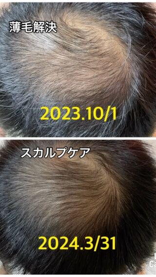 横浜元町のリフトアップ・ピーリングエステサロンへようこそ