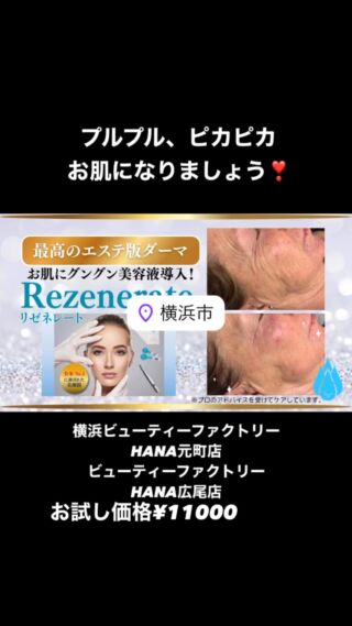 ボディ&フェイス　ハーブピーリング　剥離あり皮剥けあり➡︎７ｇ ハーブピーリング ボディ＆フェイス 剥離あり皮向けあり 7g